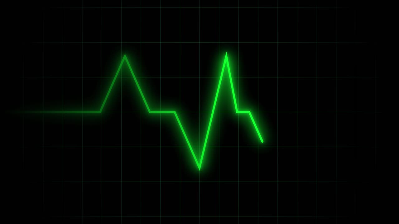 Tracciato ECG digitale del battito cardiaco su monitor medico