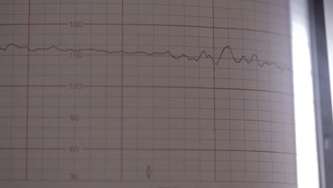 Primer-Plano-De-La-Pantalla-De-Un-Monitor-Cardíaco-Que-Toma-Lecturas-De-Un-Bebé-Dentro-Del-Vientre-De-Una-Mujer-Embarazada-Que-Se-Registra-En-Papel