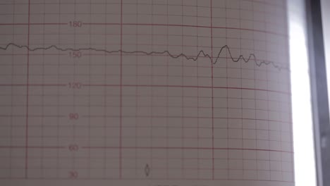 primer plano de la pantalla de un monitor cardíaco que toma lecturas de un bebé dentro del vientre de una mujer embarazada que se registra en papel