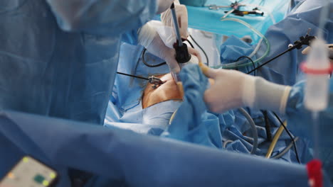 laparoscopic surgical procedure