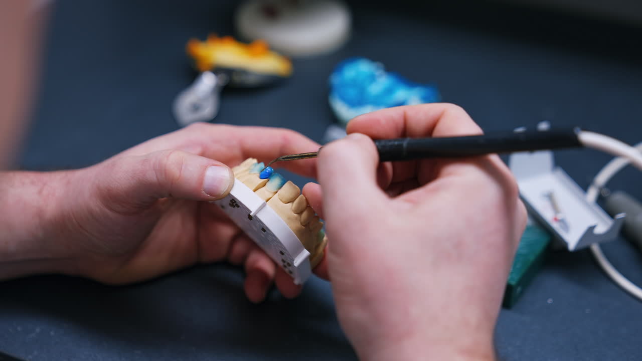 Male hands hold the denture model. Professional uses a tool for teeth implantation. Close up.