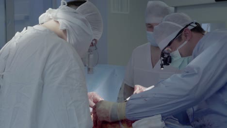 cardiosurgeons perform a cut with the help of a coagulator aorto-coronary bypass surgery