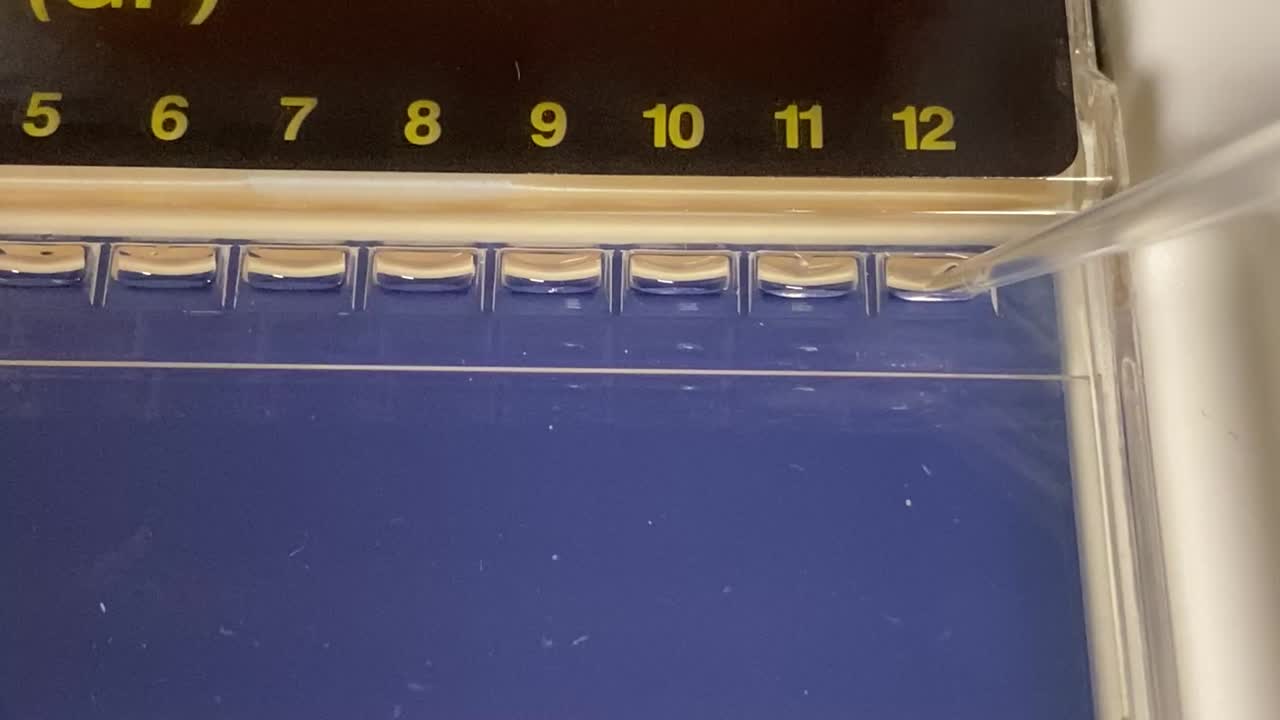 técnico biomolecular cargando muestra de adn en electrofresis en gel de agarosa