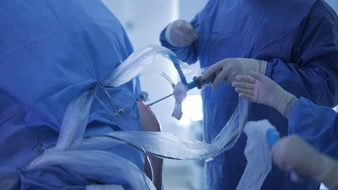 어깨 관절의 관절 검사