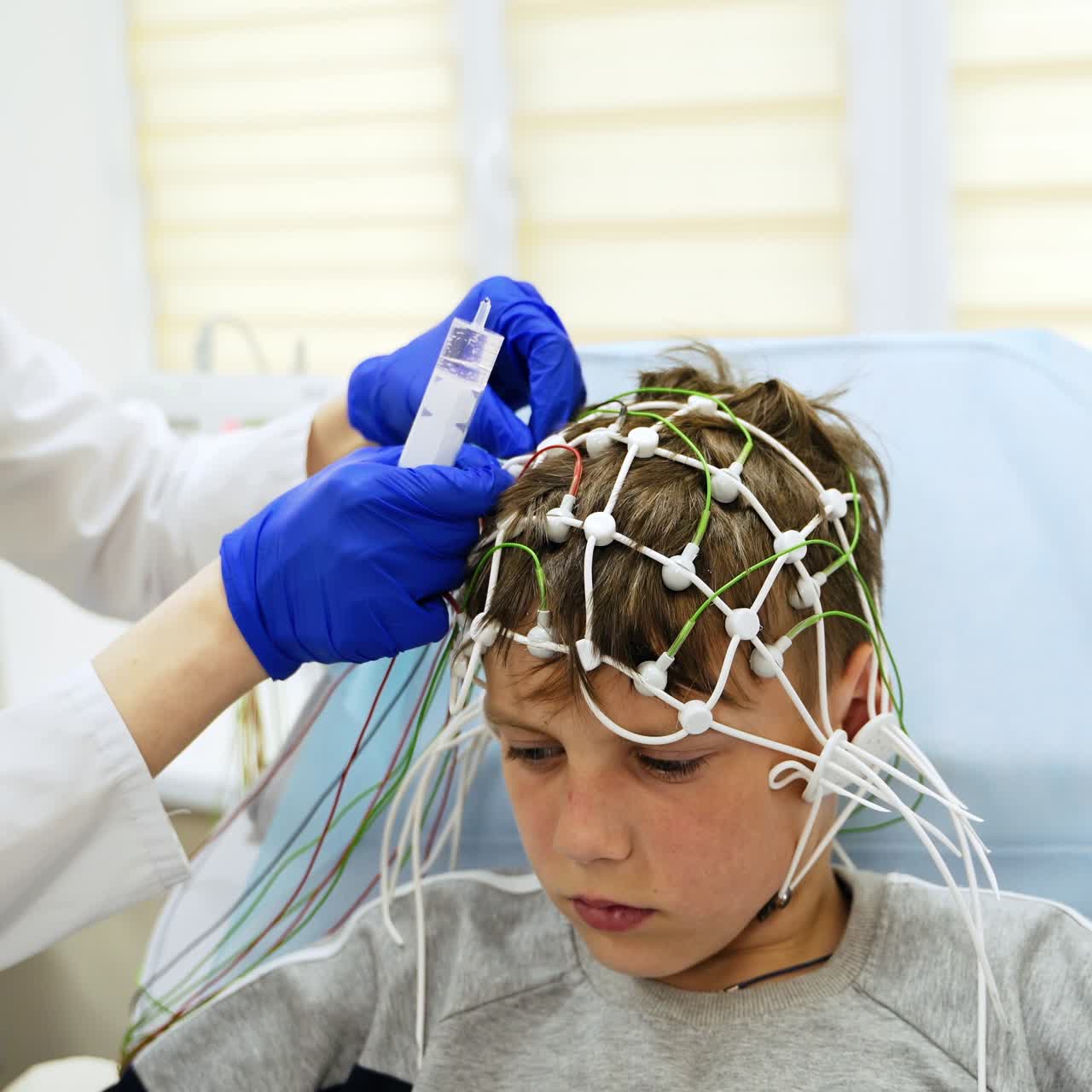 Medic applies gel on the little sensors and puts them on boy's head. Kid is prepared for EEG brain examination