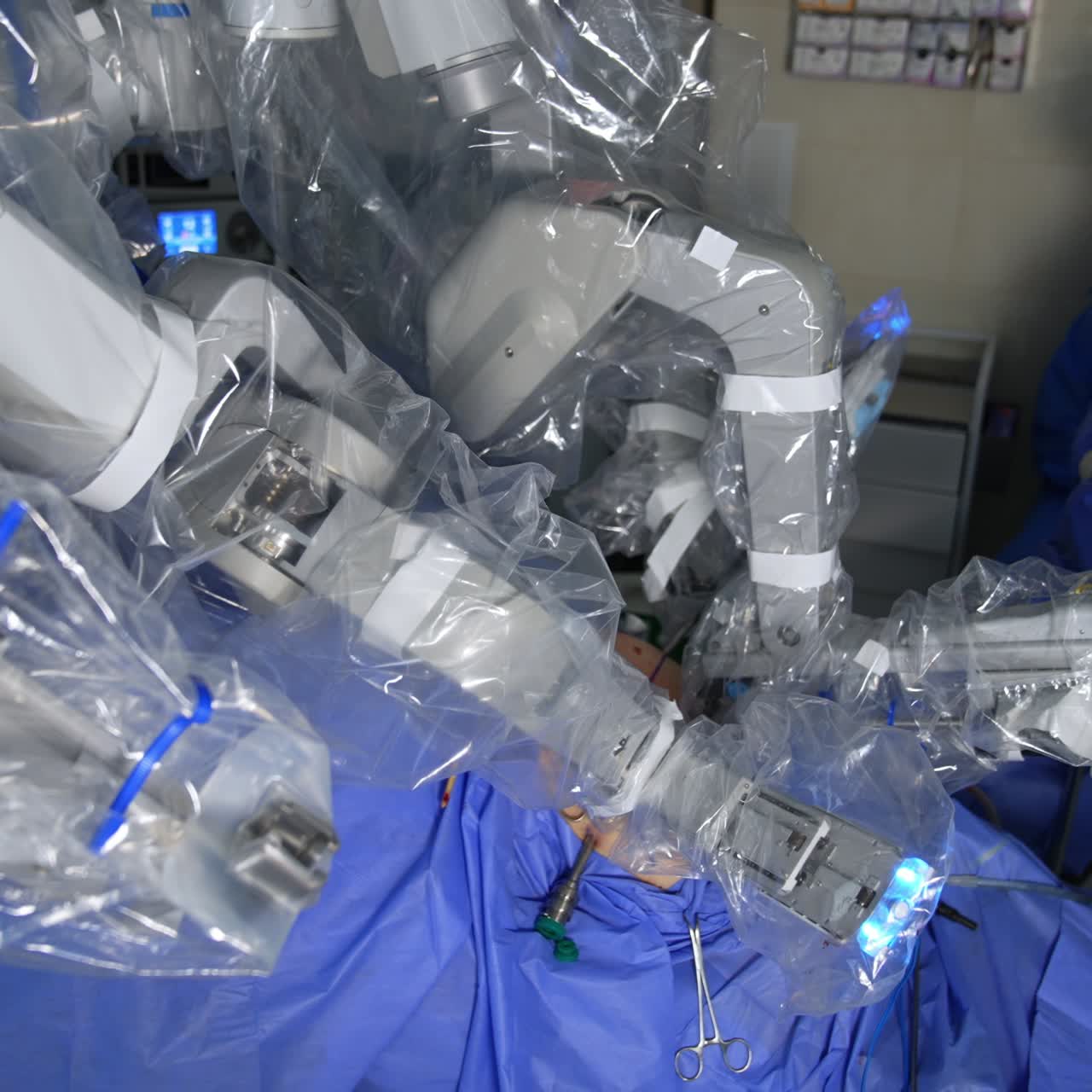 Manipulator arms of robotic equipment performing minimally invasive surgery. Surgeon at backdrop watches the procedure at the screen