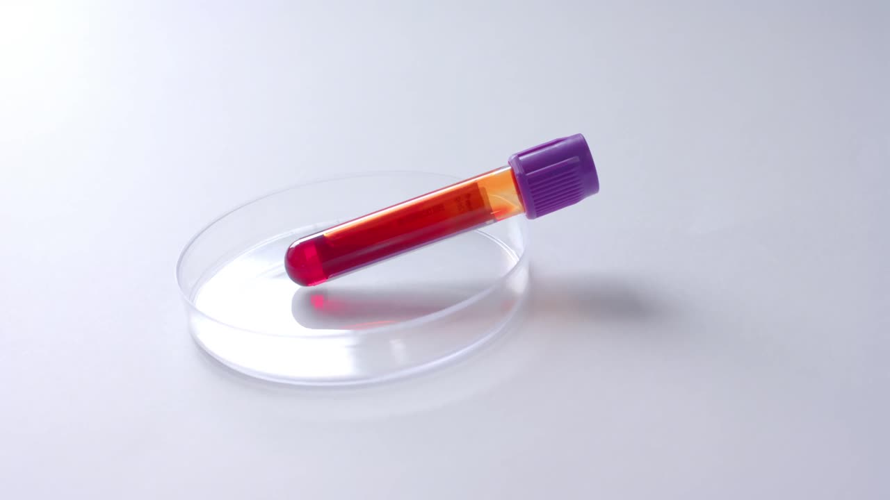Primo piano di campione di sangue e capsula di Petri su sfondo bianco con spazio per copia, slow motion.
