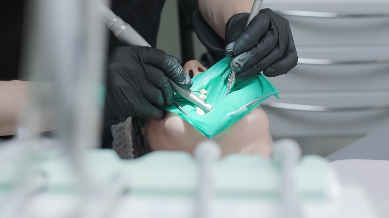 visión general de la prevención de la caries dental, niña en la silla del dentista durante un procedimiento de escamación dental,