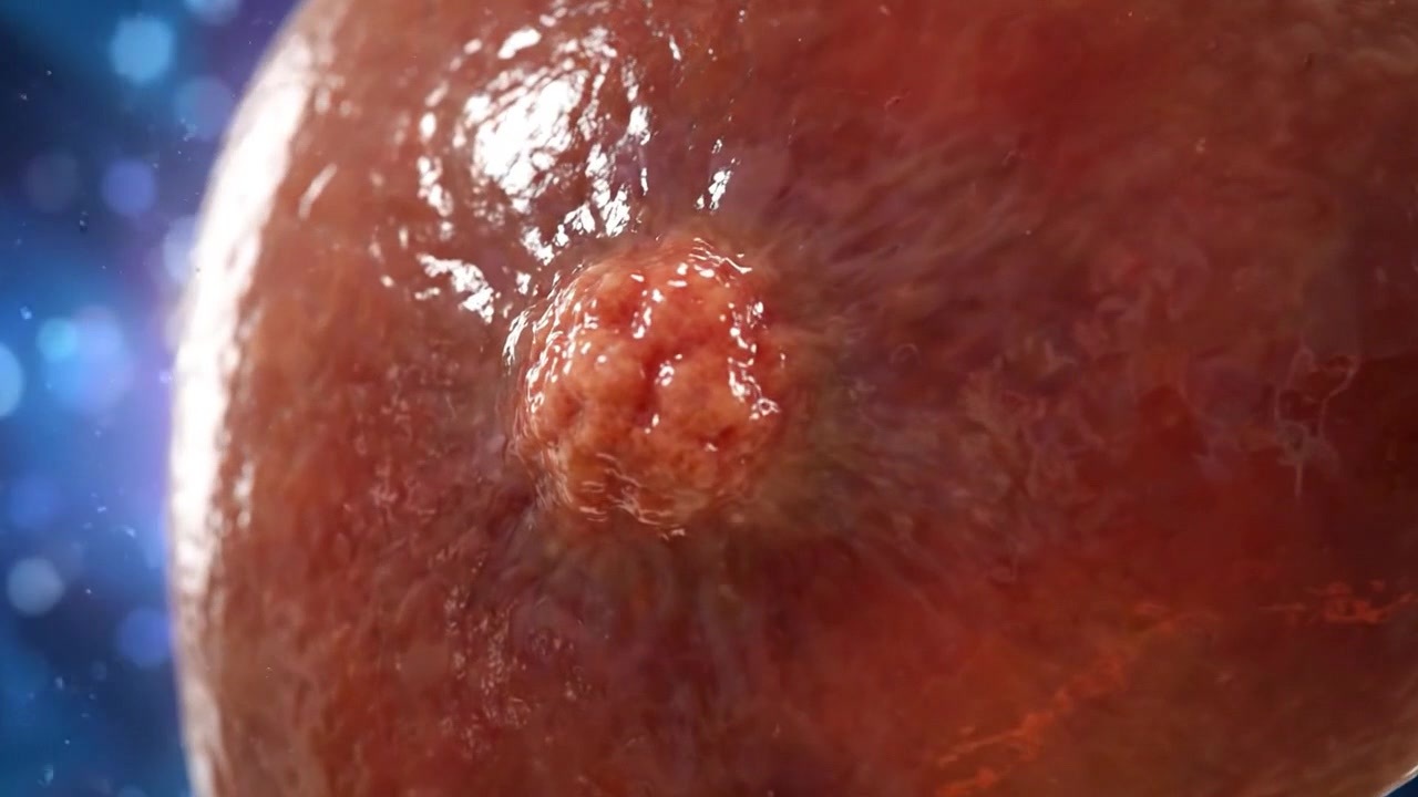 3D Medical Animation of a Human Liver with a Tumor
