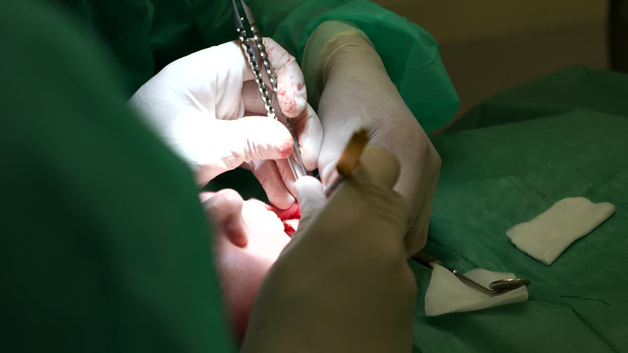 Dentist working on a dental grafting surgery on patient's gum