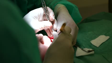 dentista trabajando en una cirugía de injerto dental en la encía del paciente