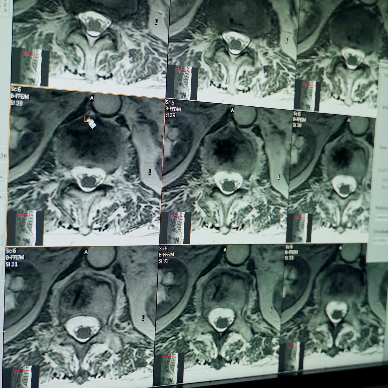Collage of many x-rays