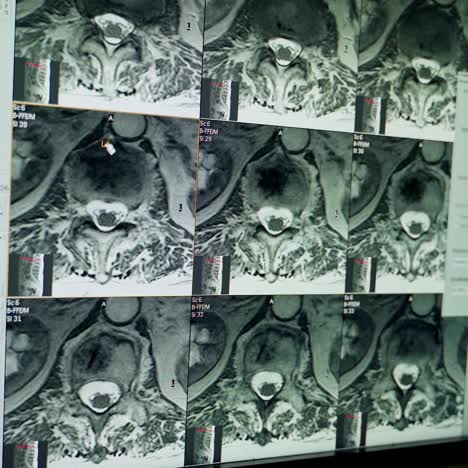 collage of many x-rays