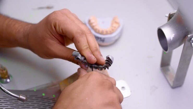 dental technician polishes metal dentures in his workshop