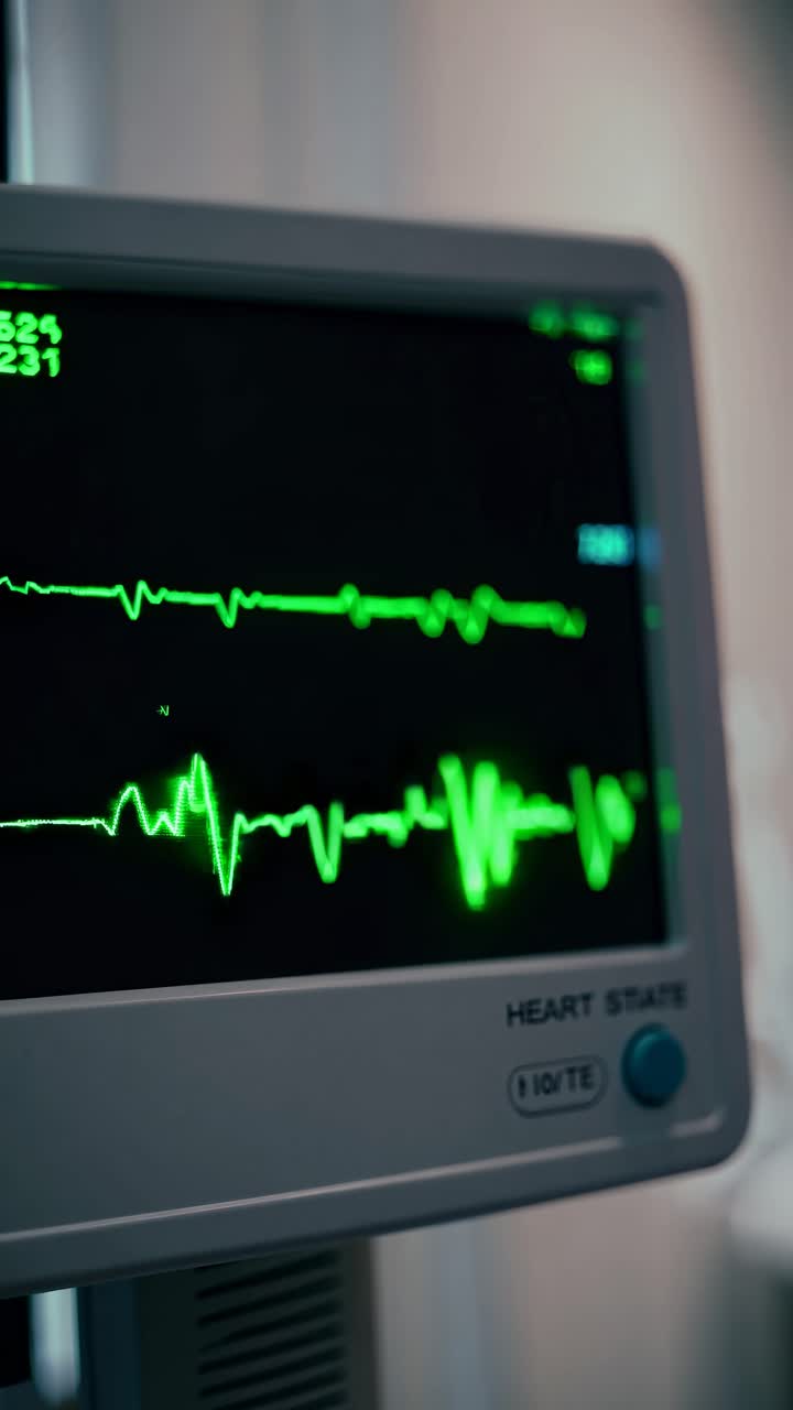 Angolazione video in primo piano di un monitor della frequenza cardiaca che mostra forme d'onda verdi su uno schermo scuro.