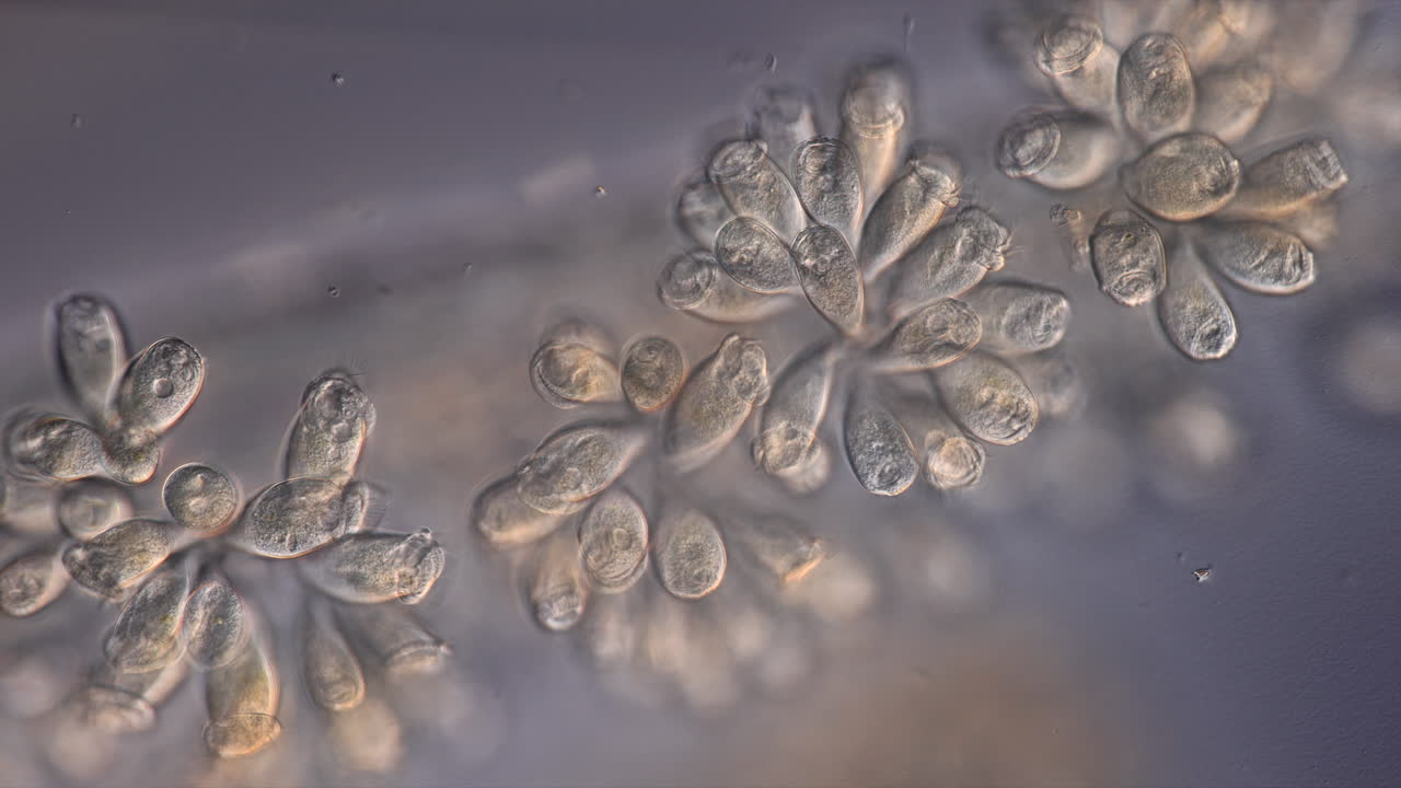 Microscopic view of colonial ciliate protozoa