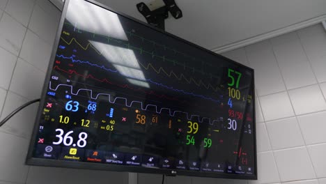 monitor de quirófano que muestra el ritmo cardíaco y la presión arterial