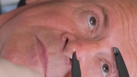 man getting eyebrow treatment