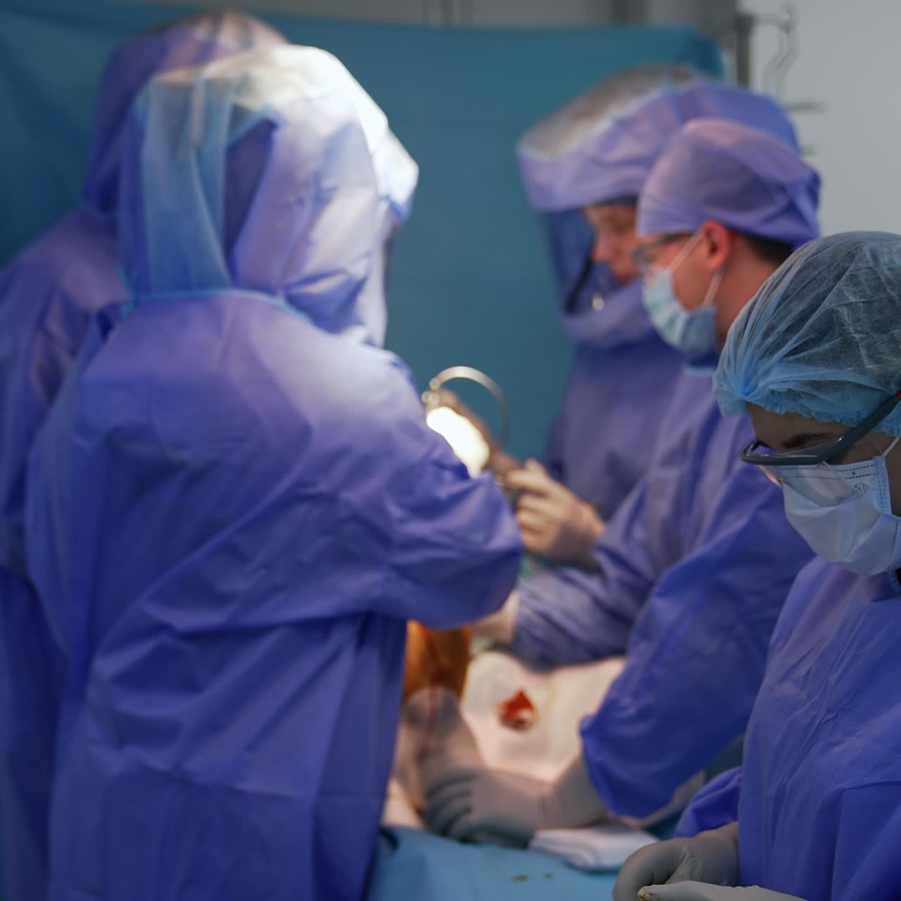 Healthcare professionals wear protective suits. Big team of surgeons collaborating at operation. Female nurse at foreground