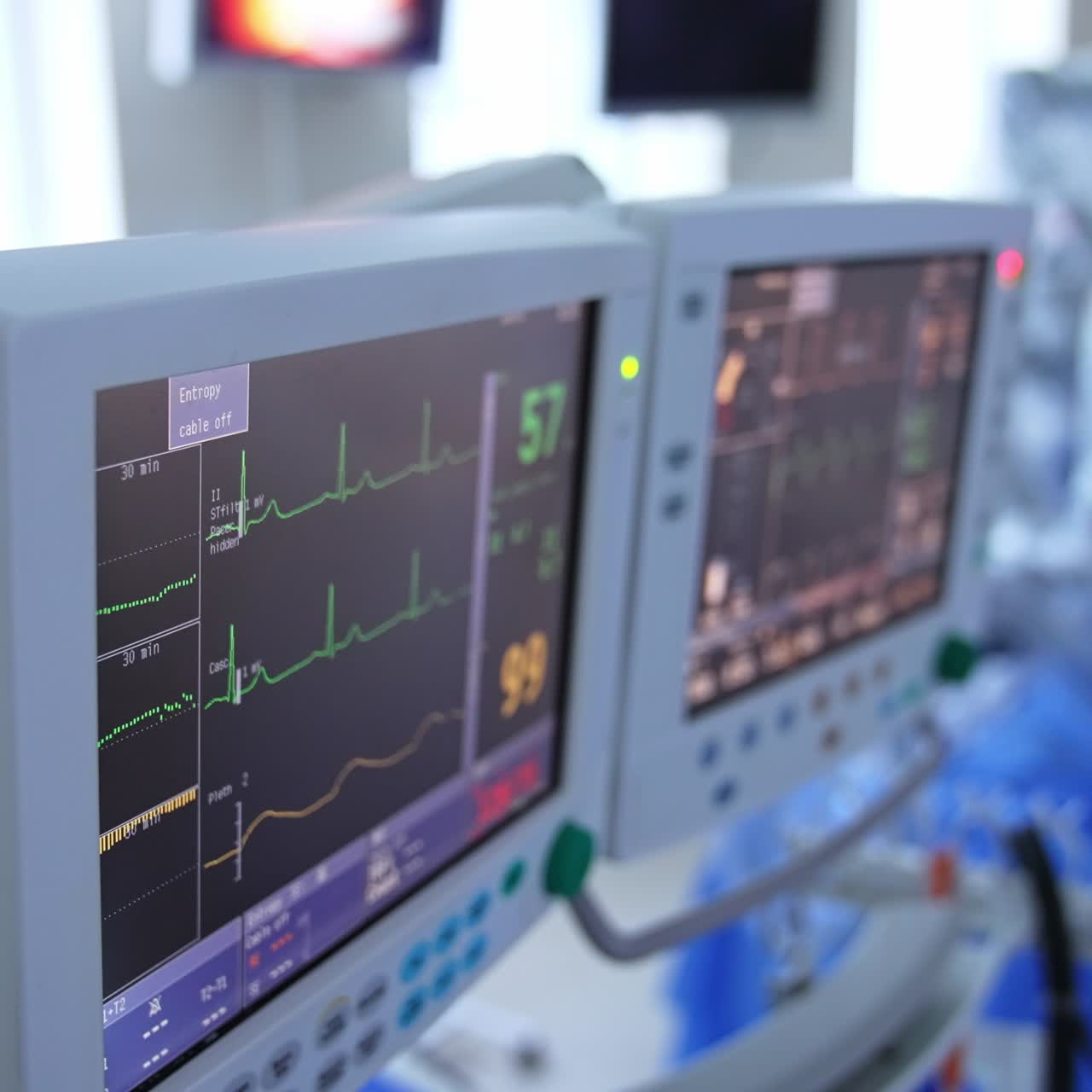 Lines, curves and numbers on the black screen of a surgical equipment. Machines showing patients vital parameters. Close up. Blurred backdrop