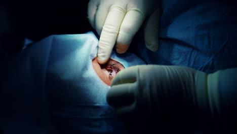 cataract professional operating. modern eye healthcare surgery.