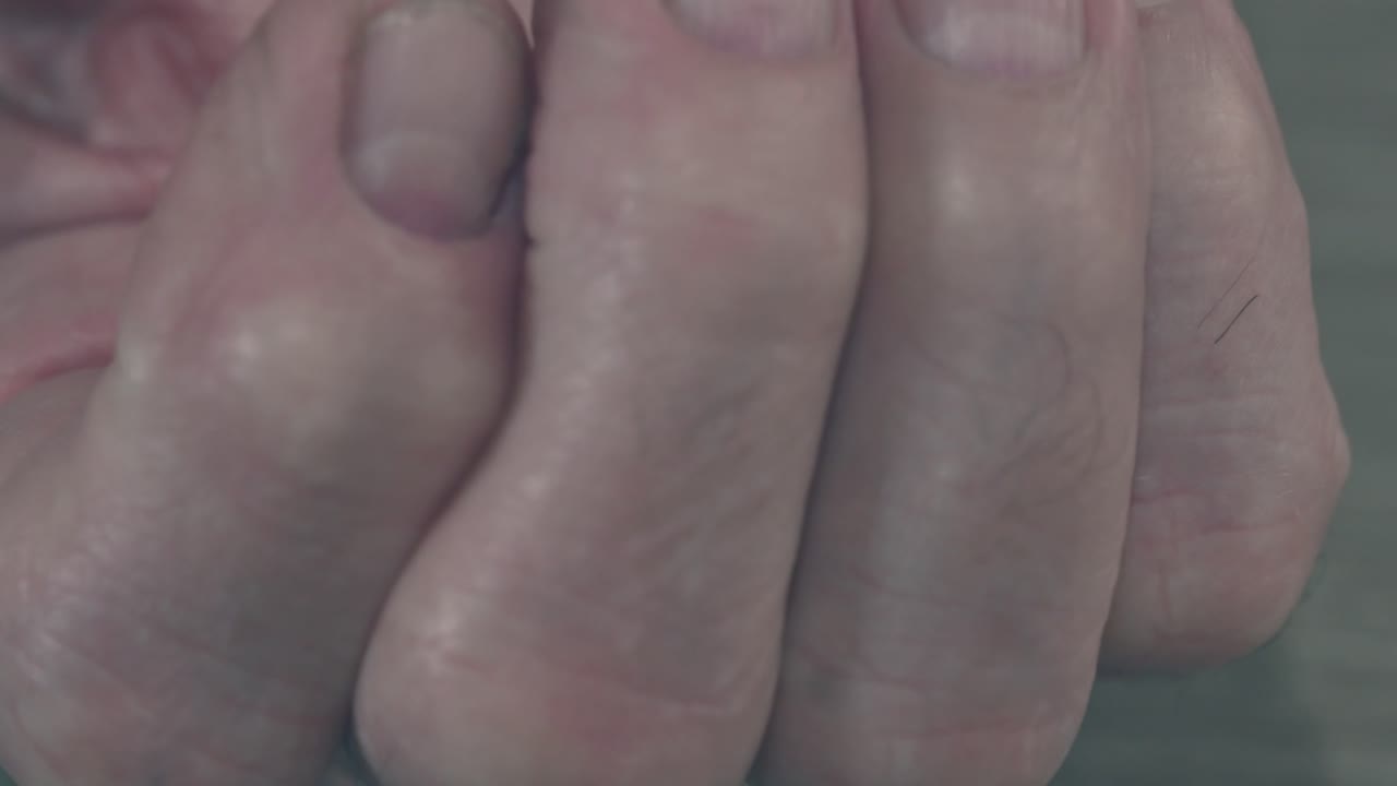 una mano piena di pillole di oppioidi