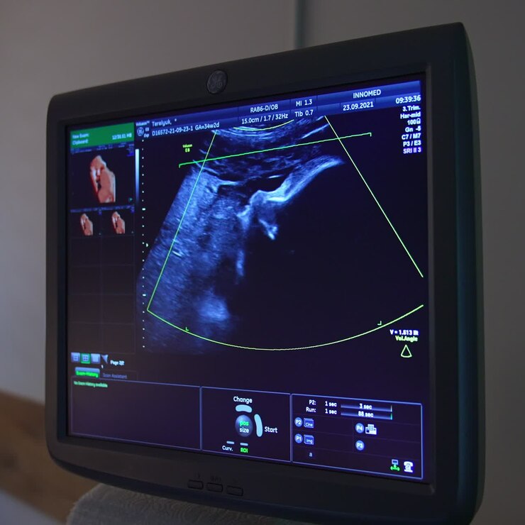 Piccolo bambino visualizzato sullo schermo nell'utero materno. Monitor blu che mostra i parametri di sviluppo del bambino.