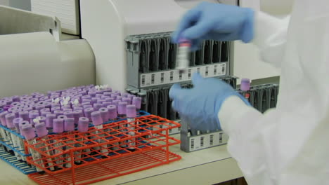 a medical technician places specimen vials into a rack