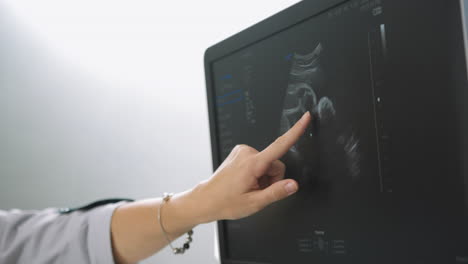 Ultrasound scan of a pregnant woman