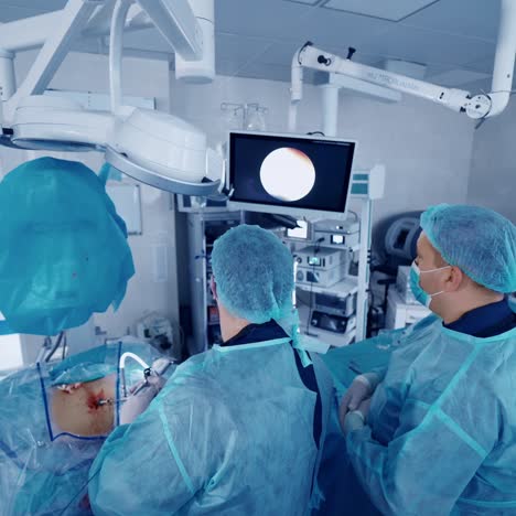 group of surgeons in the operating theatre. patient is lying on a surgical table and professional doctors perform an operation on modern medical equipment background.