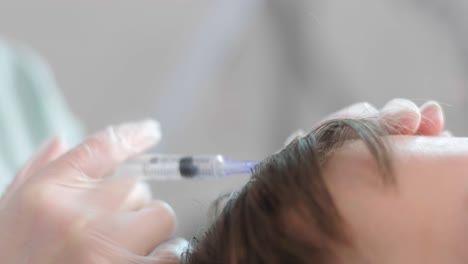 procedimiento de mesoterapia capilar en la clínica de cosmetología moderna