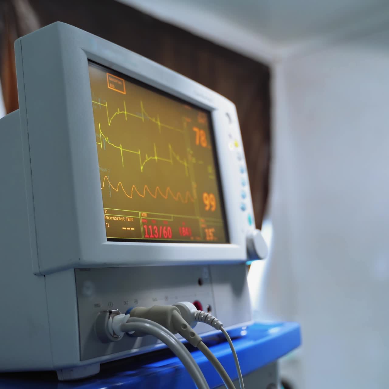 Surgical monitor in the intensive care unit. Medical equipment showing patient's heartbeat in the hospital room. Healthcare concept.