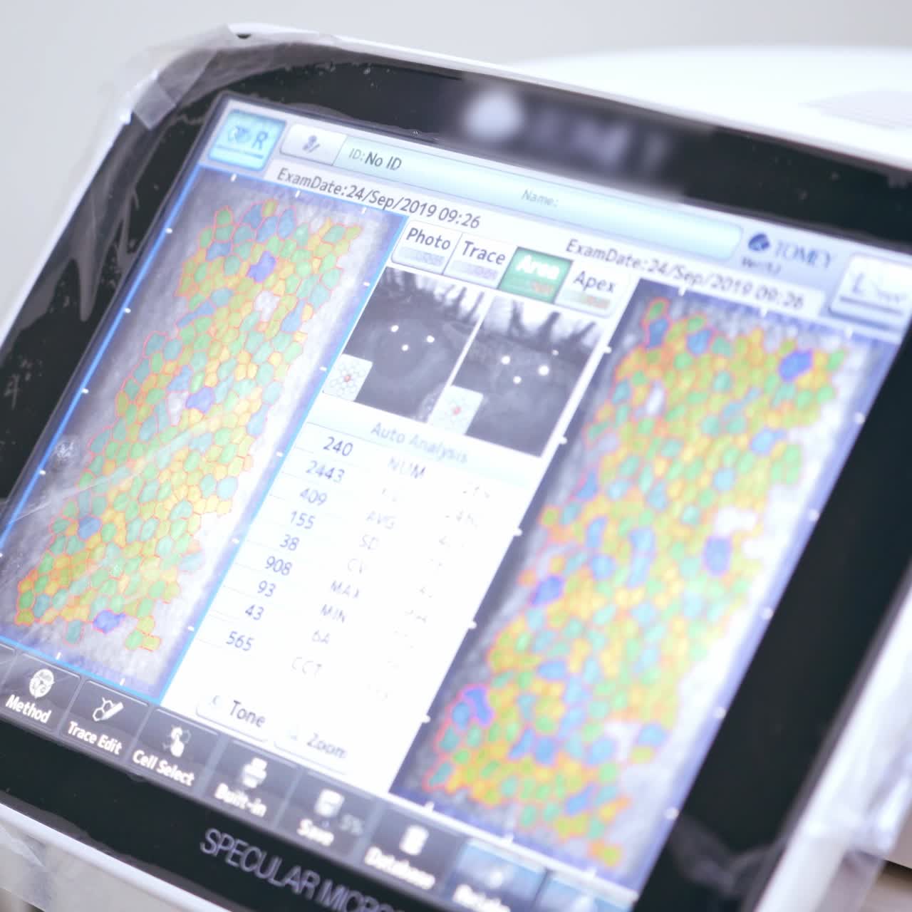 Ophthalmologist examining patient