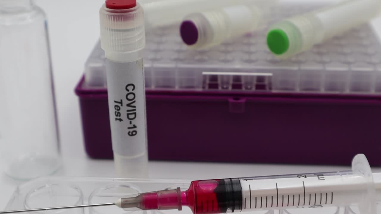 Provetta con etichetta Covid-19. Attrezzatura da laboratorio di microbiologia. Test Coronavirus, Covid-19