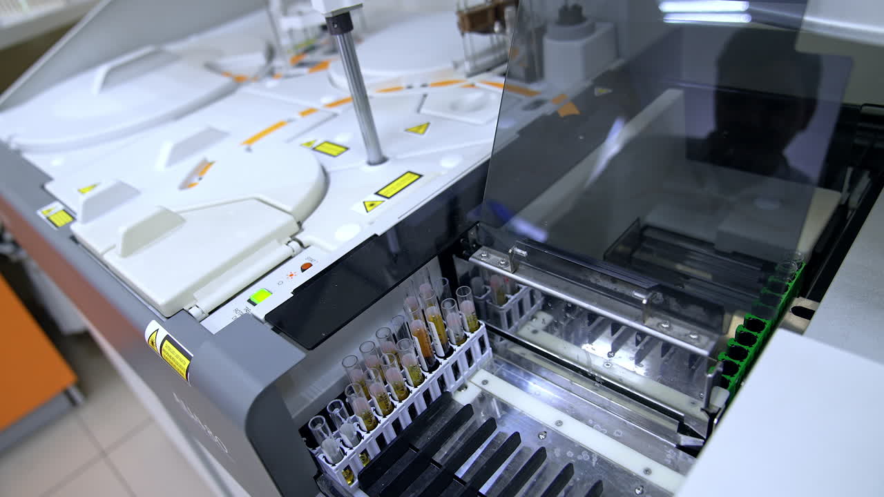 Modern advanced equipment performing science testing of blood in the hospital laboratory. Test glasses are moving inside the machine.