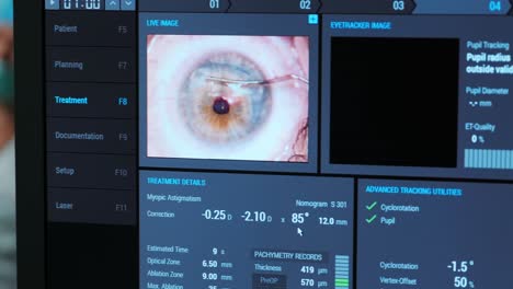cirugía oftalmológica. vista en la pantalla del monitor médico en la sala de operaciones. lasik