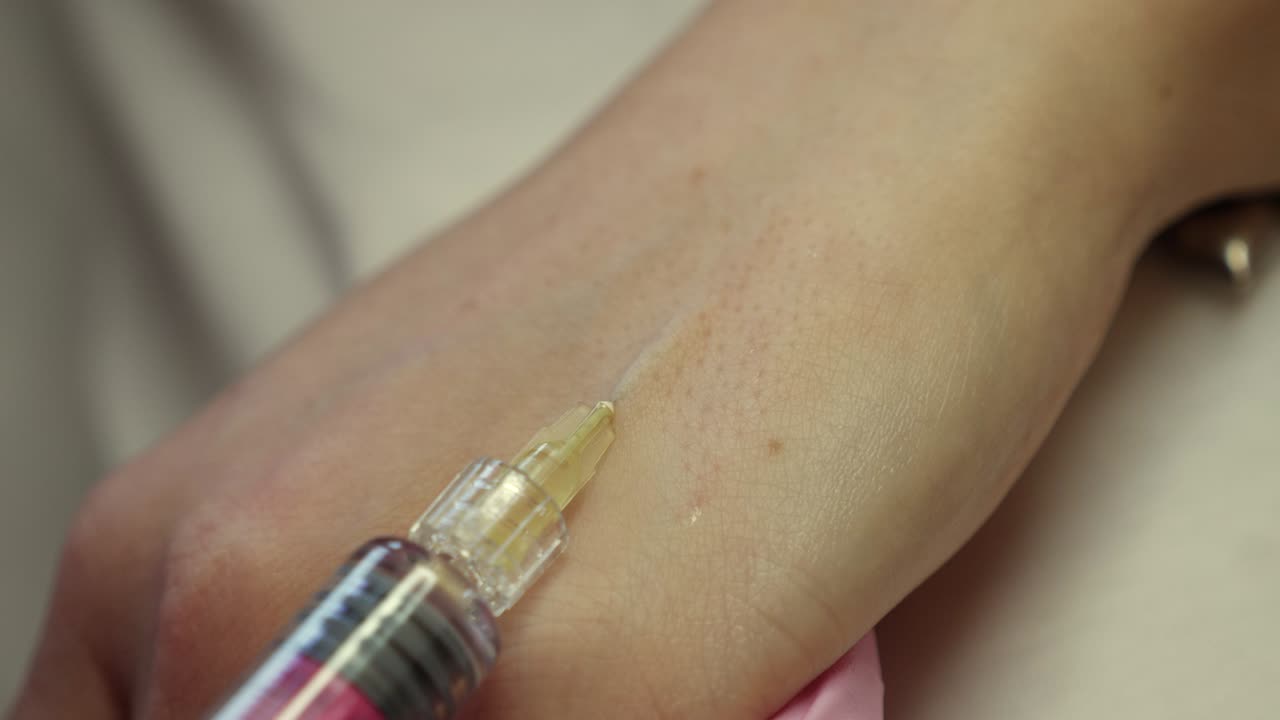 procedimiento de inyección cosmética