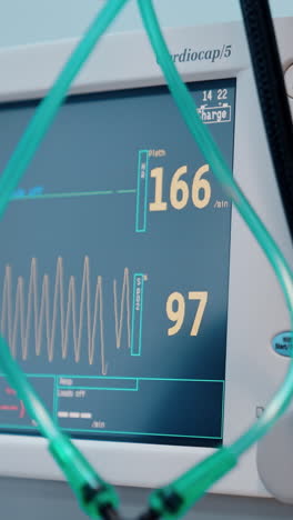gloved hand of a medic pressing the buttons on the screen of medical equipment. lung ventilator monitor closeup. vertical video