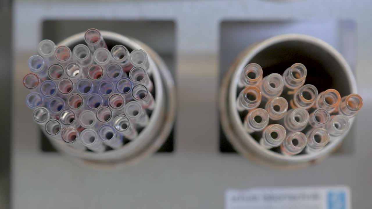 Chemistry lab test tubes tops
