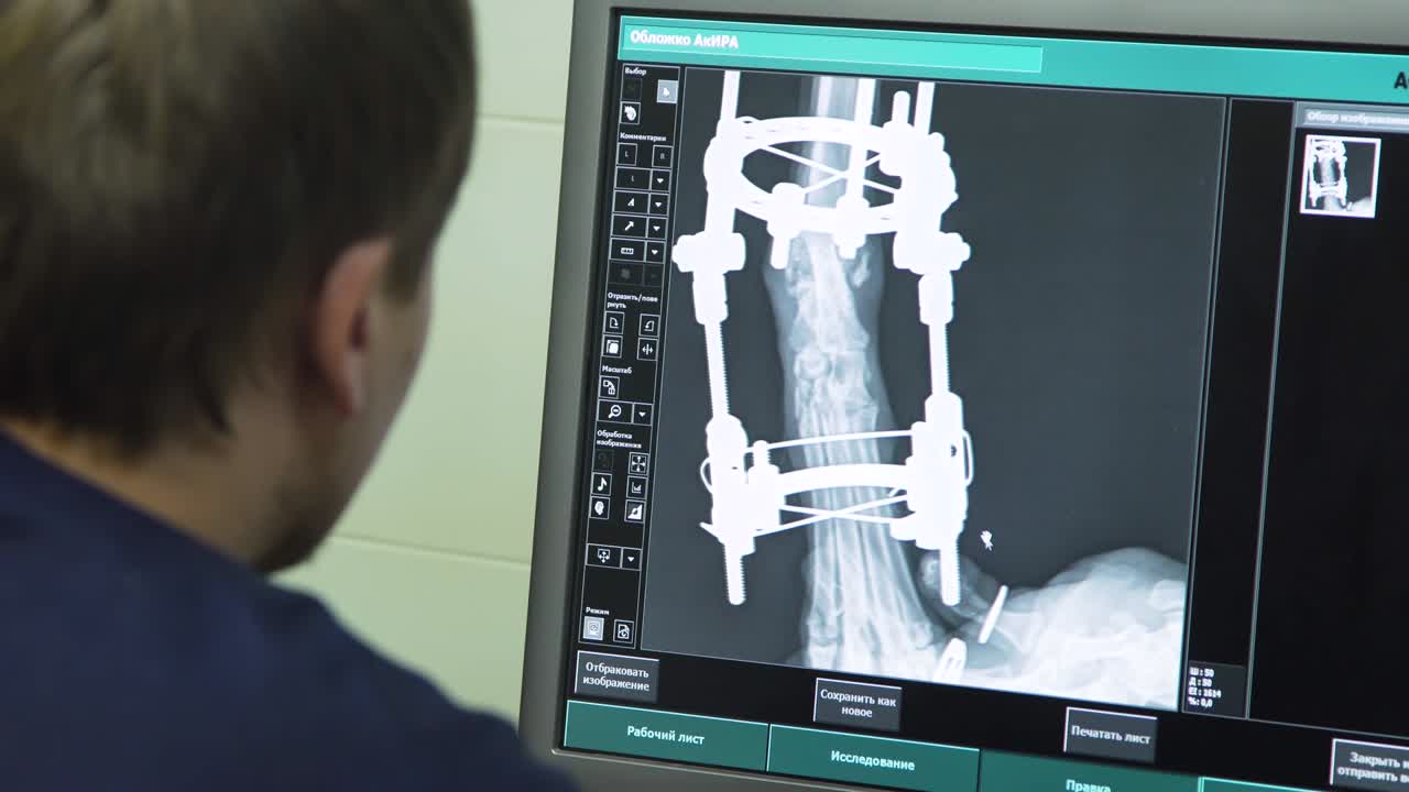 доктор смотрит рентгеновский снимок в больнице.