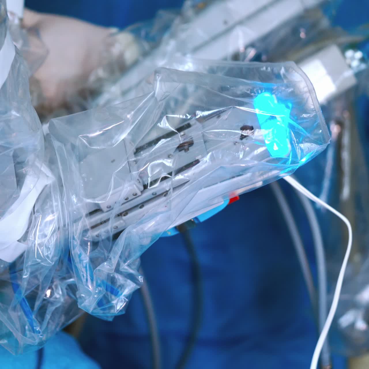 Minimally invasive robotic surgery. Cancerous tumor removal surgery. Modern medical equipment.