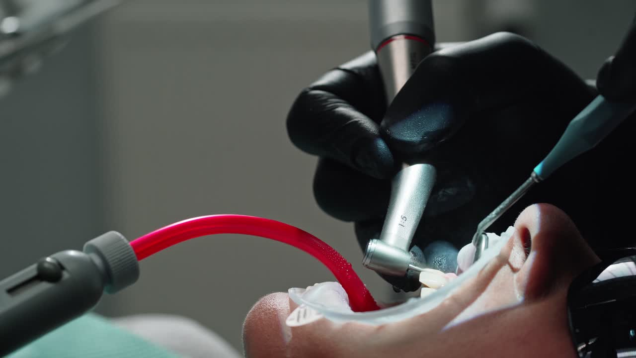 Dentist performs medical manipulations. Hands of dentist with surgical instrument