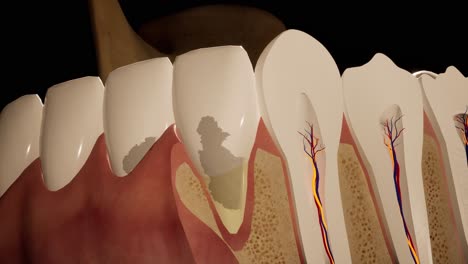 toothache. anatomical detailed section of the teeth. nerve inflammation. 3d animation