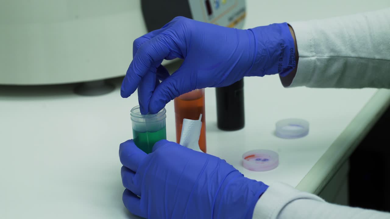 primer plano de manos en guantes azules con portaobjetos de microscopio y tratamiento químico