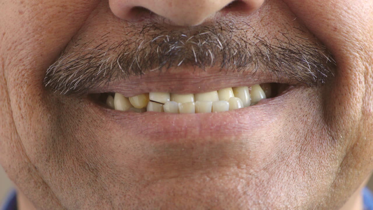 hombre con dientes amarillos desiguales sonriendo