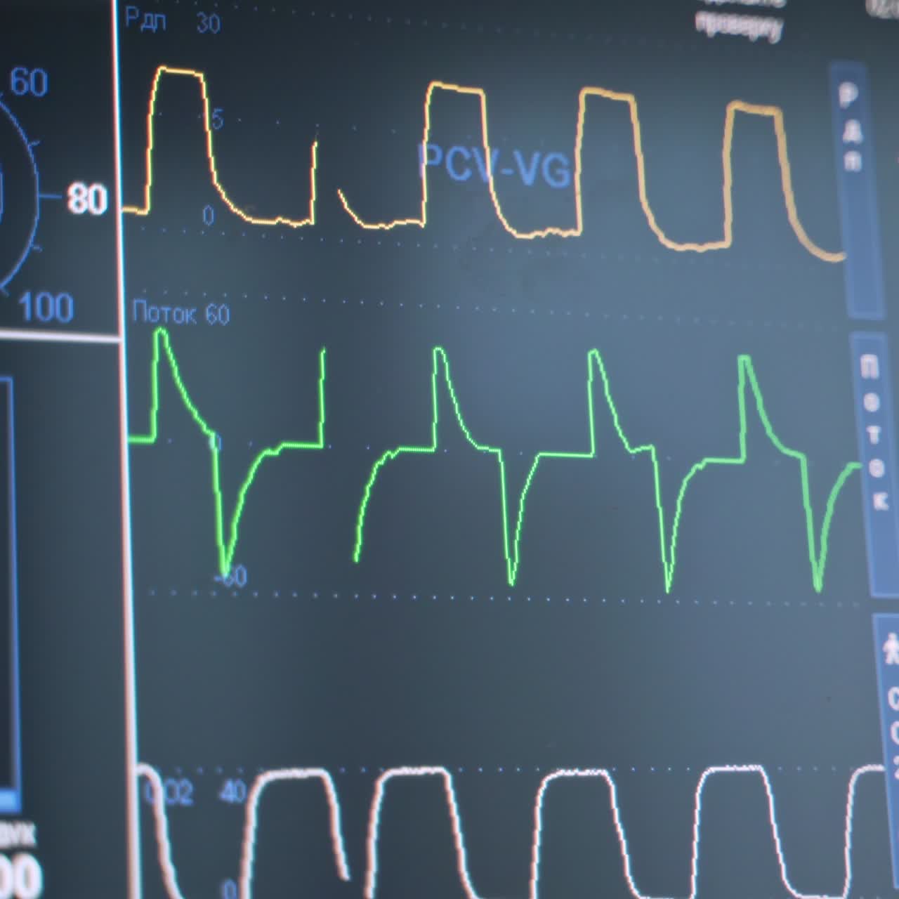 Screen of monitor during surgery in operating room. Emergency room with modern equipment showing patient's vital sign.