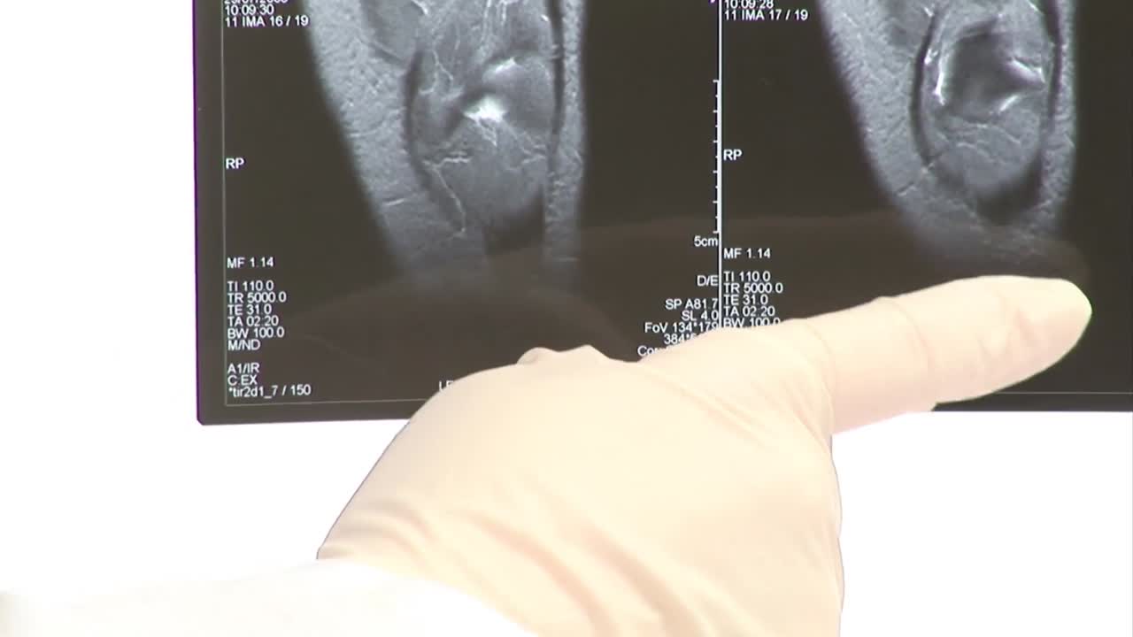 ⁇ 스레이 검사