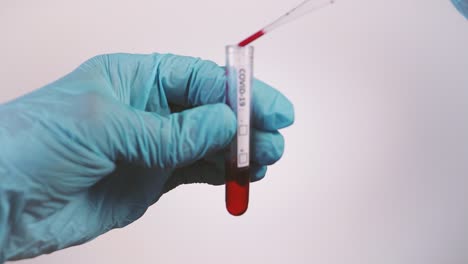 gloved hands use pipette to drop blood into vial for covid-19 testing