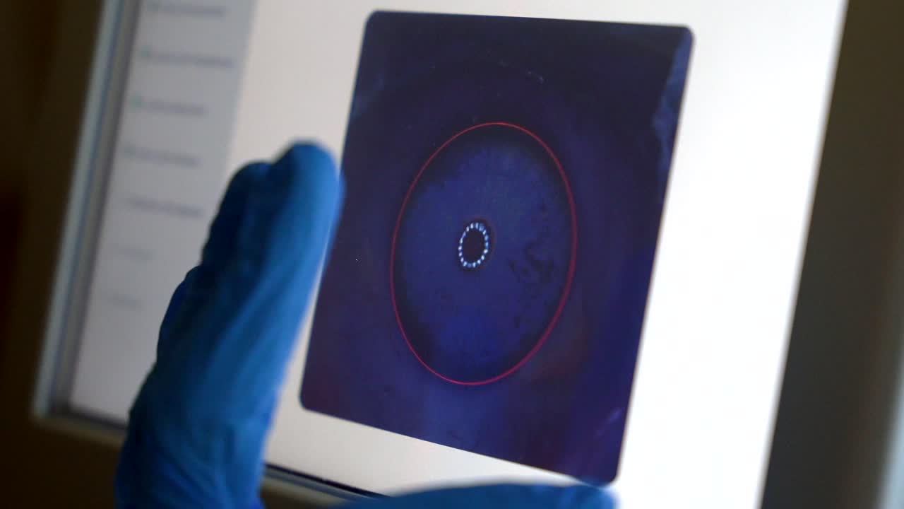 Medical Eye Scanning Technology