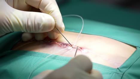 skilled surgeons perform suturing on an incision, showcasing precise techniques and attention to hygiene. this is a critical aspect of post-operative care in the operating room.